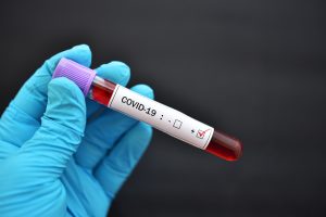 Особенности инфекции и тестирования Covid-19