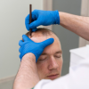 Миноксидил для мужчин: эффективное средство против выпадения волос