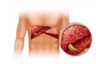 Эластометрия печени